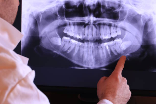 Best Orthodontic Emergency Dentist in Endicott, NY