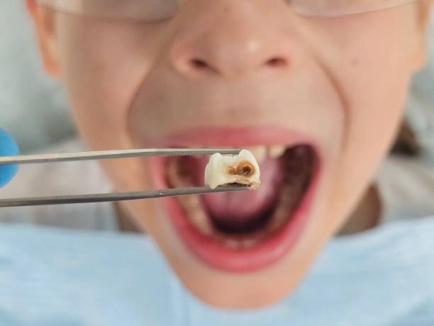 Best Emergency Cosmetic Dentistry in Endicott, NY